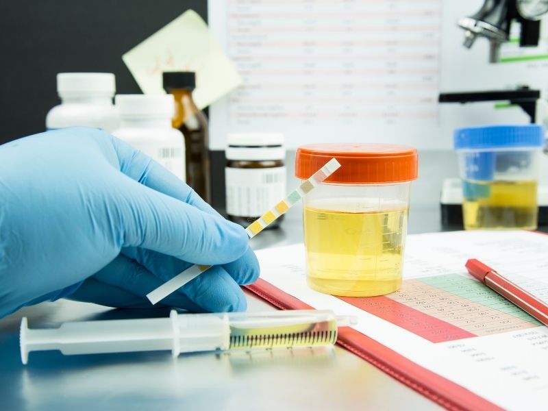 gebelik-idrar-ve-kan-testleri