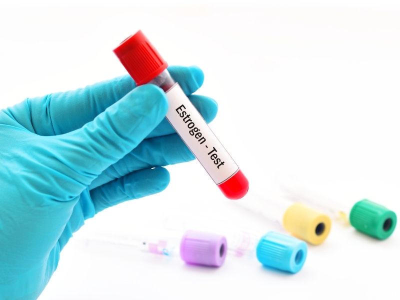 menopoz-doneminde-yapilan-hormon-testleri