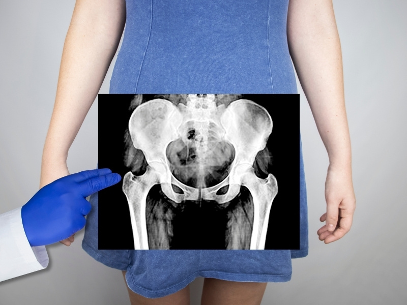 pelvik-taban-egzersizleri