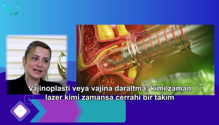 video,paylaşım,kameralı telefon,videofon,ücretsiz,yükleme